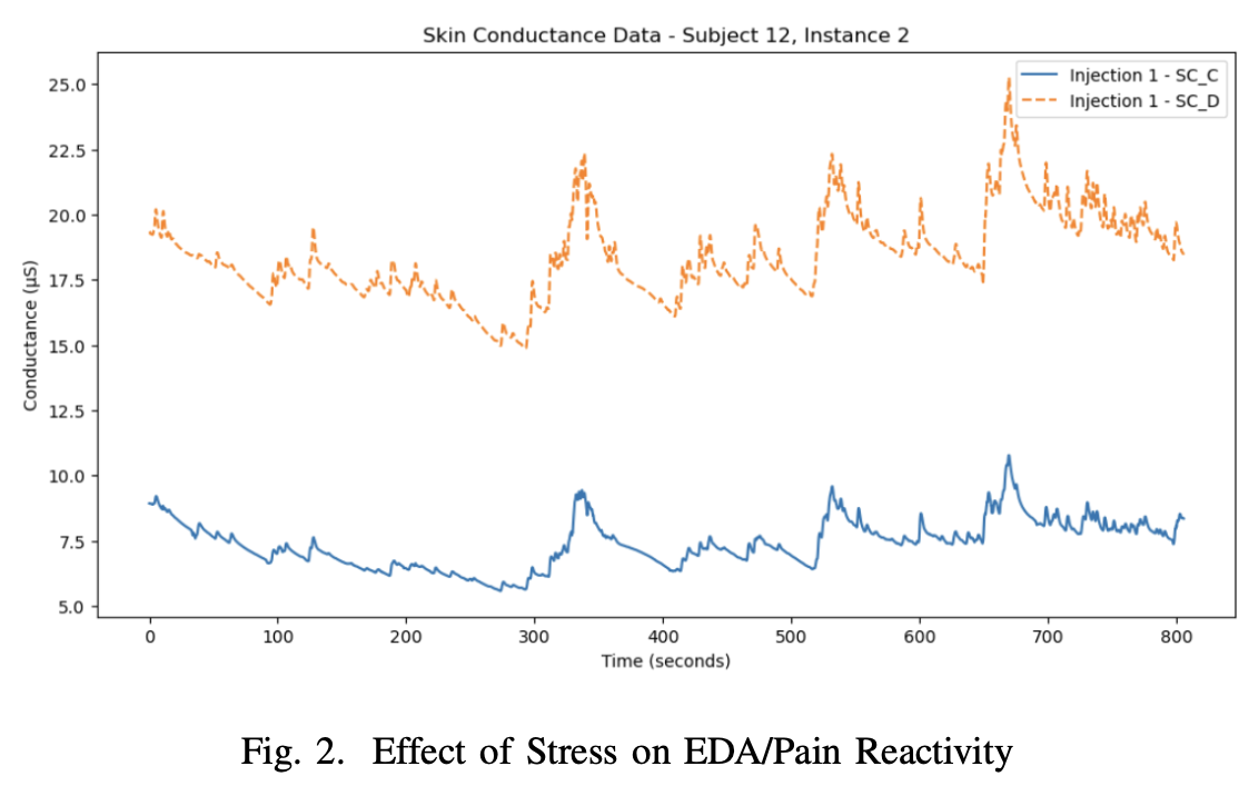 Integrating Anticipatory and Physiological Factors to Predict Injection Pain Intensity