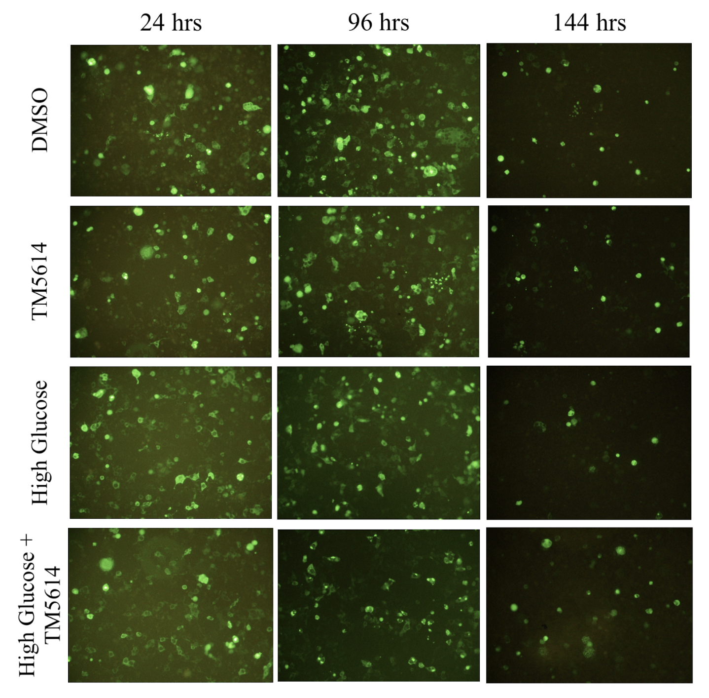 SERBP1: Exploiting RNA-Binding Protein-Mediated PAI-1 Inhibition